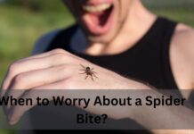 When to worry about a guide spider bite?