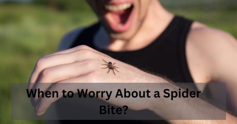 When to worry about a guide spider bite?