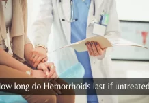 How Long Do Hemorrhoids Typically Last? how long do hemorrhoids last