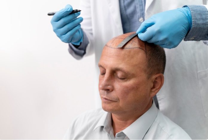 leading hair transplant in Mumbai leading hair transplant in Mumbai